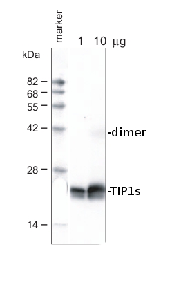 western blot using anti-TIP1s antibodies